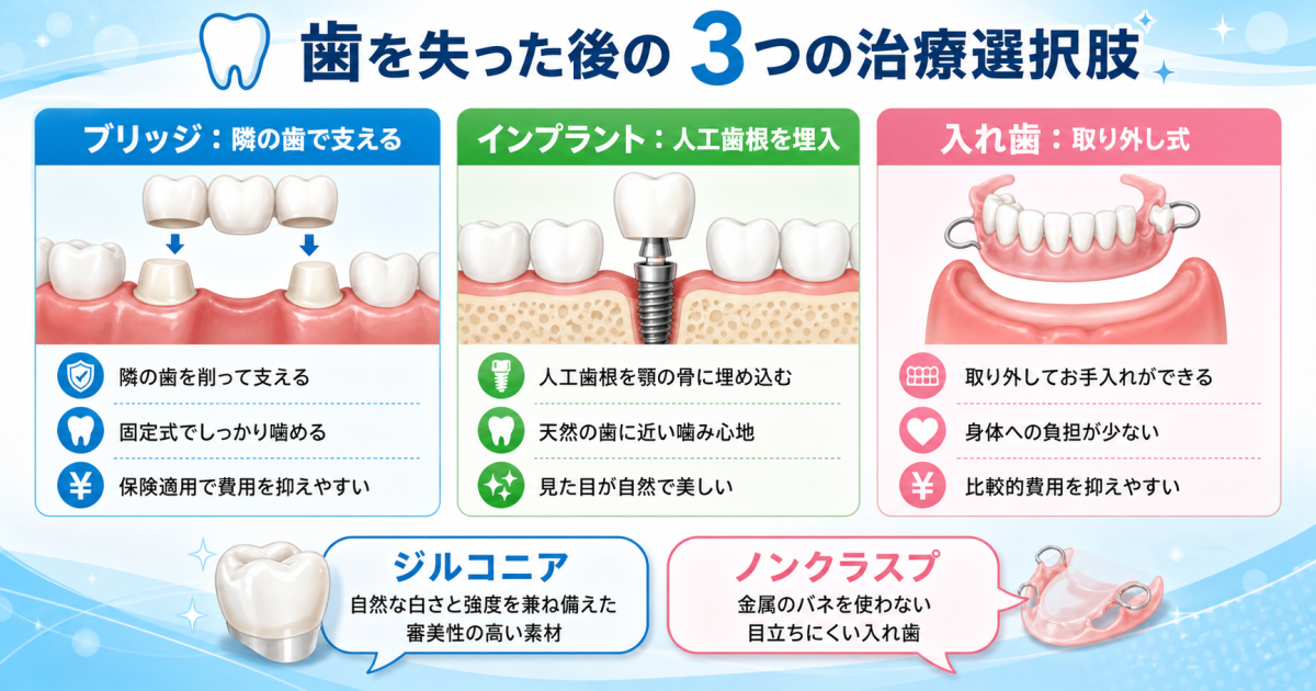 歯を失った時の治療法は？ブリッジ・インプラント・入れ歯を比較｜ジルコニアやノンクラスプも解説