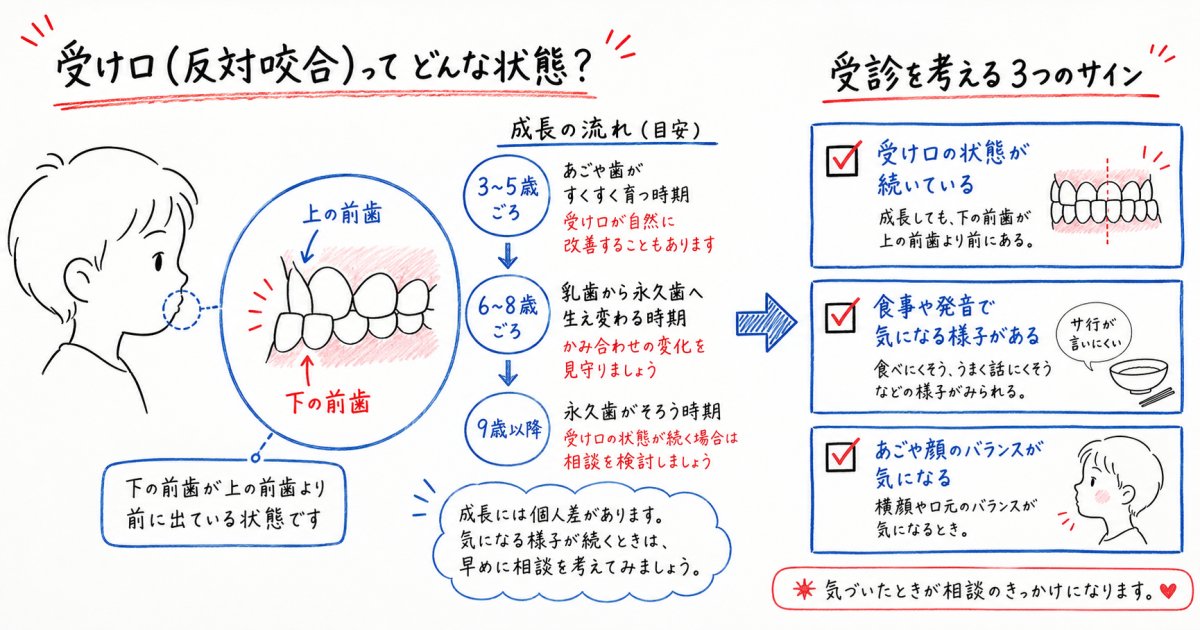 子どもの受け口は自然に治る？様子見の限界と受診を決める3基準